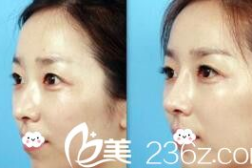 安徽整形美容,引领时尚潮流,塑造美丽人生
