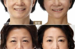 龙岩整形,专业机构汇聚，美丽蜕变之旅